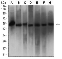 1 - Anti-Calreticulin Antibody AP95715