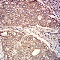 19 - Anti-Calpain 1 Antibody AP95717