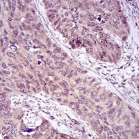 19 - Anti-Caspase 7 Antibody AP95718