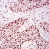 19 - Anti-CBX2 Antibody AP95720