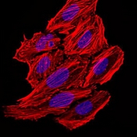 3 - Anti-CCL2 Antibody AP95722
