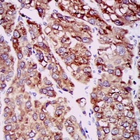 19 - Anti-CCL2 Antibody AP95722