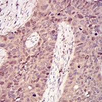 19 - Anti-Cyclin A2 Antibody AP95723