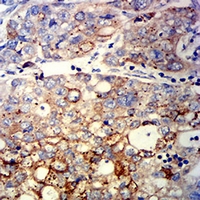 19 - Anti-Cyclin D1 Antibody AP95724