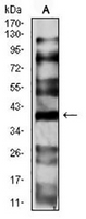 1 - Anti-CD191 Antibody AP95725