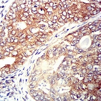 19 - Anti-CCR5 Antibody AP95726