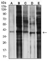 1 - Anti-CCR5 Antibody AP95726