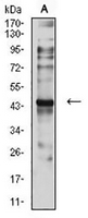 1 - Anti-CCR7 Antibody AP95728