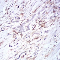 19 - Anti-CD14 Antibody AP95729