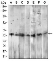 1 - Anti-CD14 Antibody AP95729
