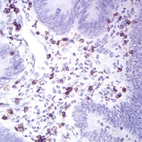 19 - Anti-CD2 Antibody AP95733