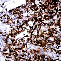 19 - Anti-CD2 Antibody AP95734