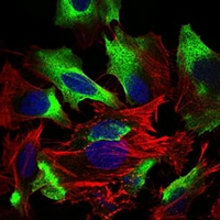 3 - Anti-CD22 Antibody AP95736