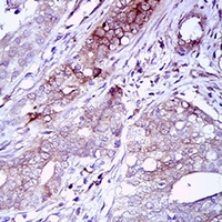 19 - Anti-CD22 Antibody AP95736