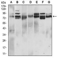 1 - Anti-CD22 Antibody AP95736