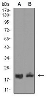 1 - Anti-CD3d Antibody AP95739