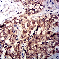 19 - Anti-CD47 Antibody AP95744