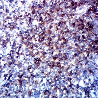 19 - Anti-CD5 Antibody AP95745