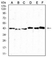 1 - Anti-CD5 Antibody AP95745