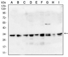 1 - Anti-CD81 Antibody AP95750