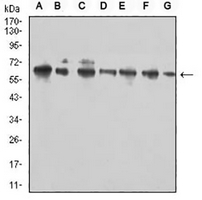 1 - Anti-CD96 Antibody AP95752