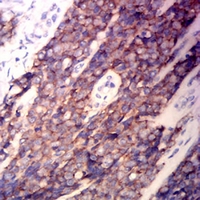 19 - Anti-CD99 Antibody AP95754