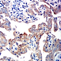 19 - Anti-E Cadherin Antibody AP95756