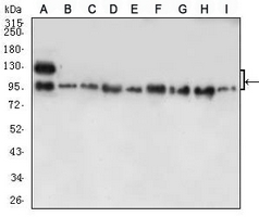 1 - Anti-E Cadherin Antibody AP95756