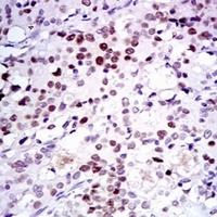 19 - Anti-CDK2 Antibody AP95760