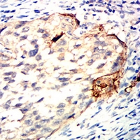 19 - Anti-CDK4 Antibody AP95761