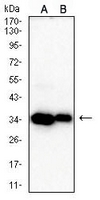 1 - Anti-CDK4 Antibody AP95761