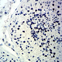 19 - Anti-p57 Kip2 Antibody AP95762