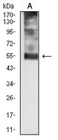 1 - Anti-p57 Kip2 Antibody AP95762