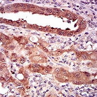 19 - Anti-p16 INK4a Antibody AP95763