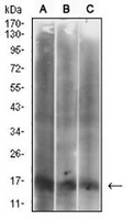 1 - Anti-p16 INK4a Antibody AP95763