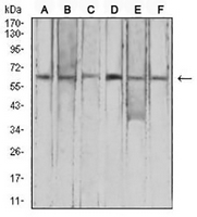 1 - Anti-FHR-5 Antibody AP95769