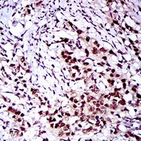 19 - Anti-c-FLIP Antibody AP95770