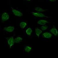 3 - Anti-CHD3 Antibody AP95771
