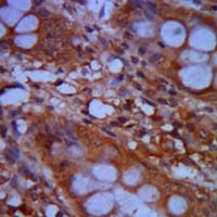 19 - Anti-CHD3 Antibody AP95771