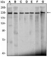 1 - Anti-CHD3 Antibody AP95771
