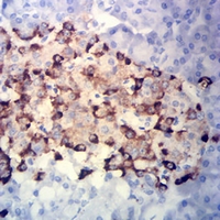 19 - Anti-Chromogranin A Antibody AP95772