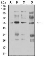 1 - Anti-CHRNA5 Antibody AP95773