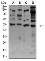 1 - Anti-AChR alpha 7 Antibody AP95774