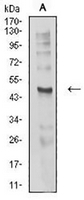 1 - Anti-AChR delta Antibody AP95775