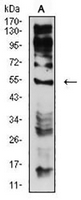 1 - Anti-CHRNE Antibody AP95776