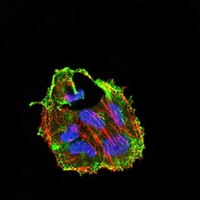 3 - Anti-CIDEC Antibody AP95777