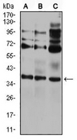 1 - Anti-CIDEC Antibody AP95777