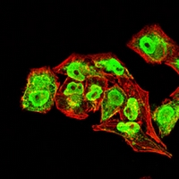 3 - Anti-Collagen 2 alpha 1 Antibody AP95782