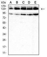 1 - Anti-Collagen 2 alpha 1 Antibody AP95782