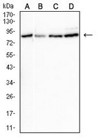 1 - Anti-CPT2 Antibody AP95783